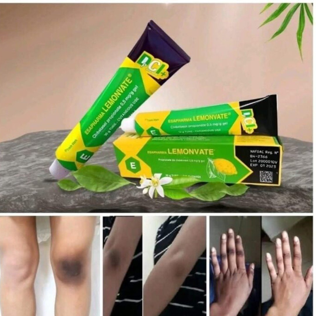 Lemonvate Cream - Image 2